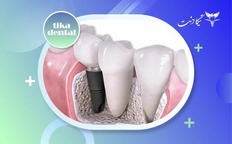 علائم جوش خوردن دندان