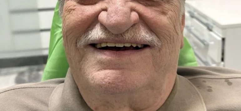 ایمپلنت فوری در تهران