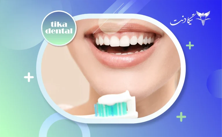 خمیر دندان برای کامپوزیت