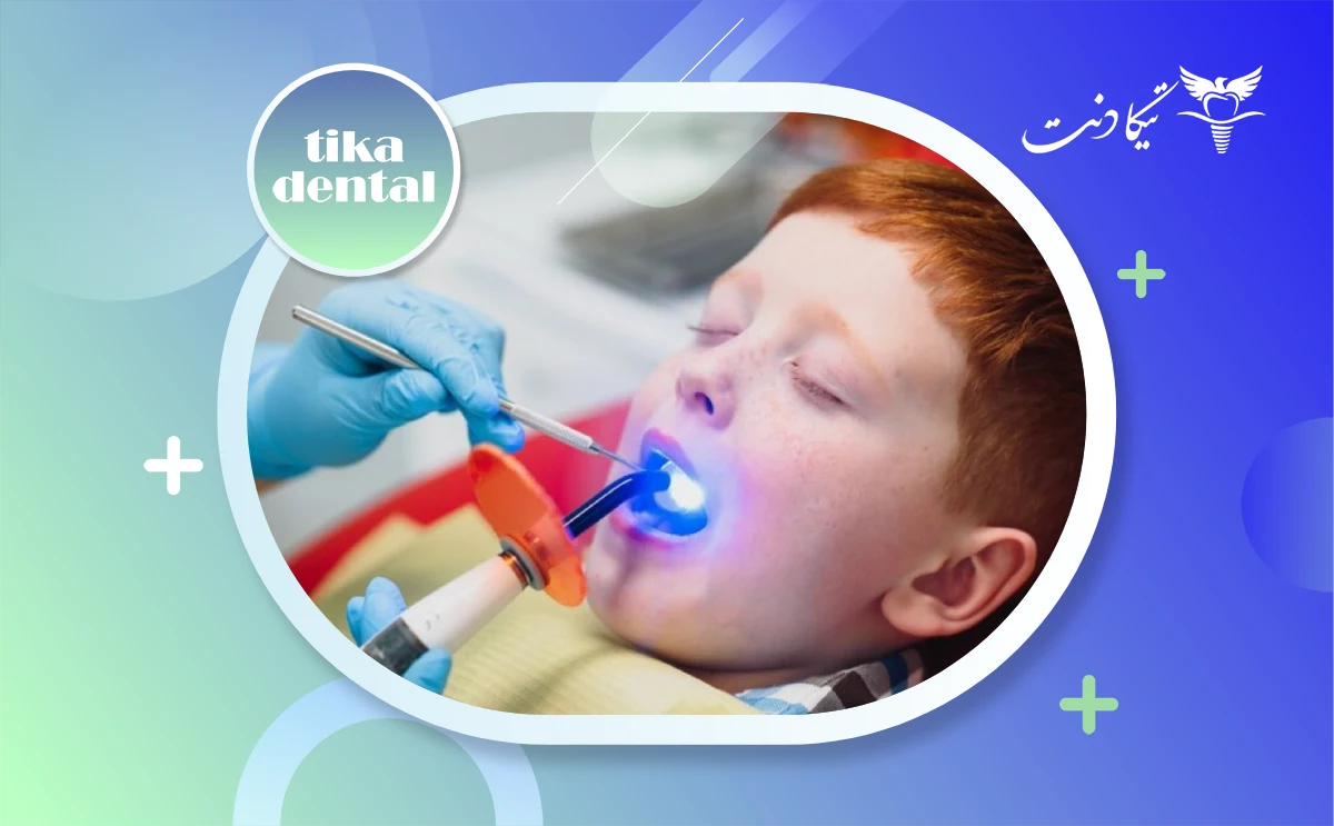 سن مناسب برای بلیچینگ دندان