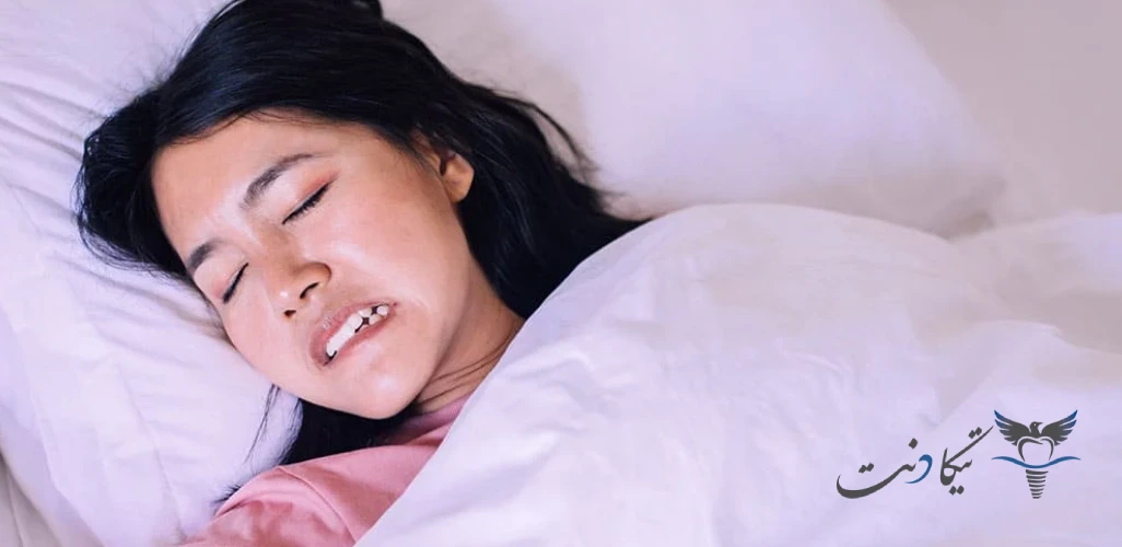 علائم دندان قروچه در خواب