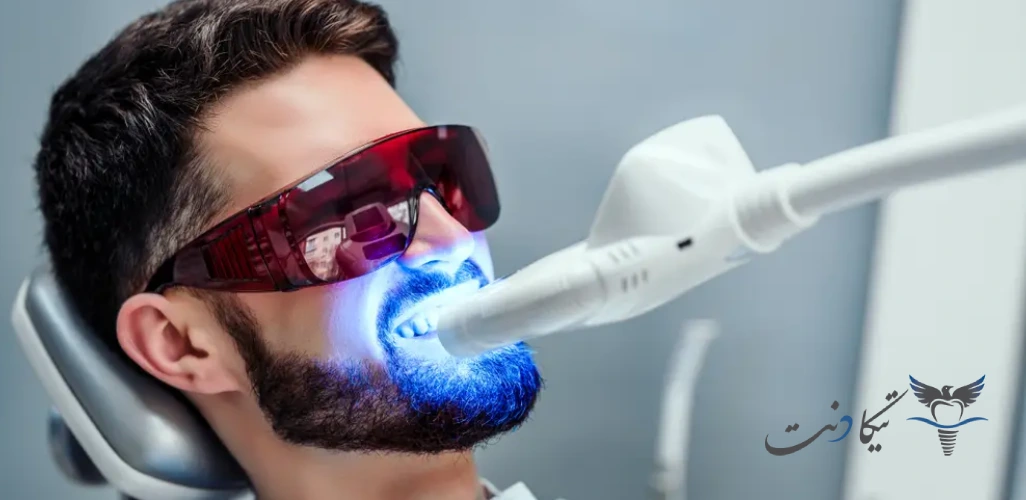 مقایسه بلیچینگ با جرم گیری