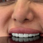 قیمت کامپوزیت سرامیکی