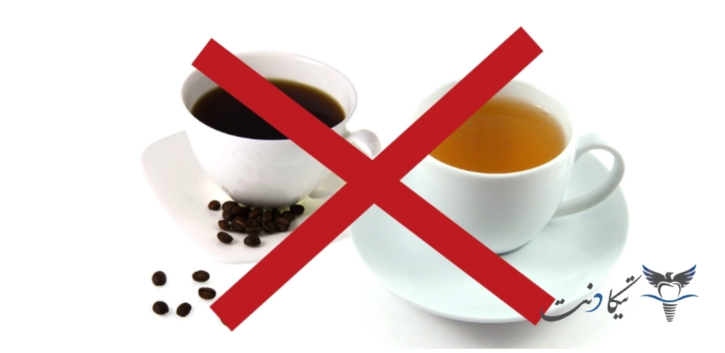 مراقبت های بعد از کامپوزیت دندان در روزهای ابتدایی