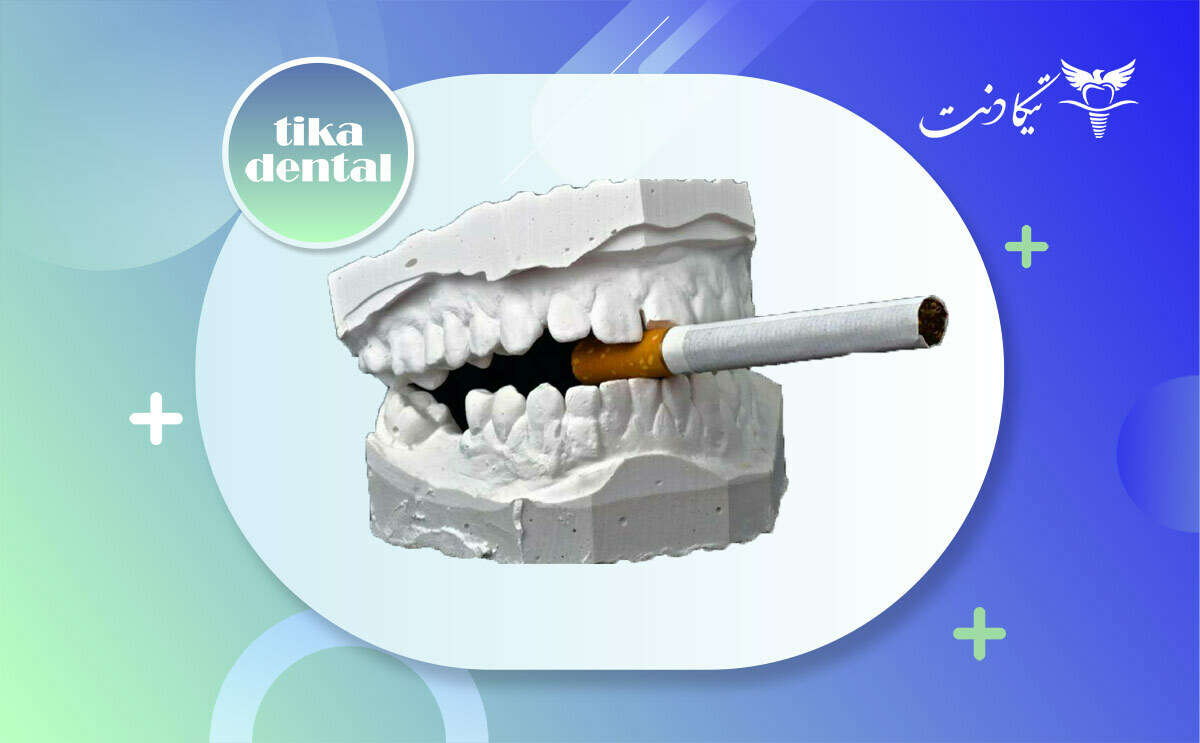 ایمپلنت برای افراد سیگاری