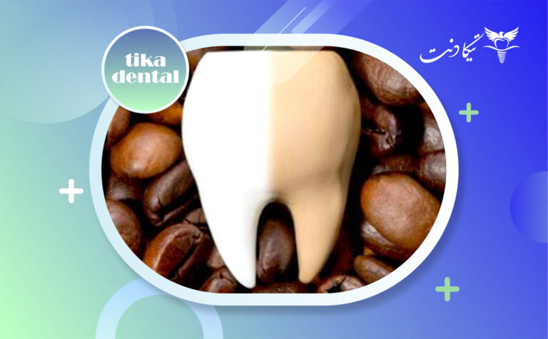 تاثیر قهوه بر رنگ کامپوزیت