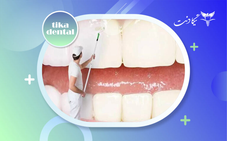 تفاوت بروساژ و بلیچینگ