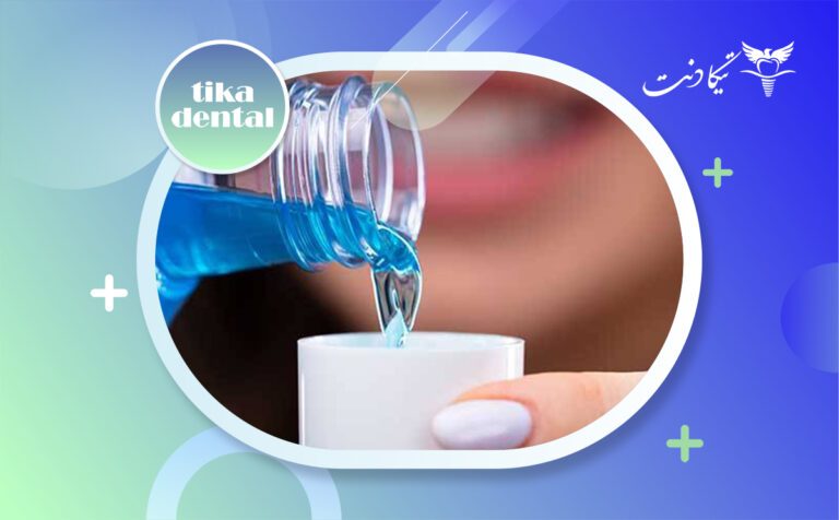 دهانشویه بعد از ایمپلنت