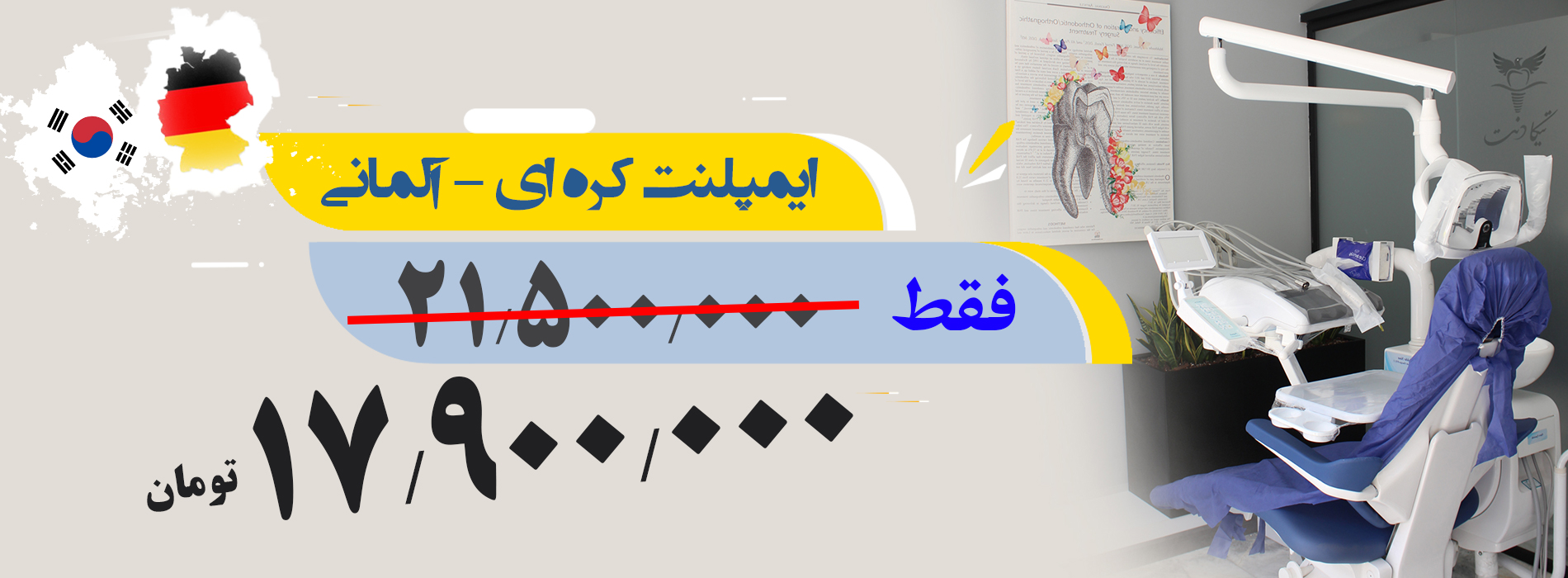 ایمپلنت کره ای آلمانی
