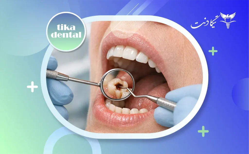 مراقبت بعد از عصب کشی