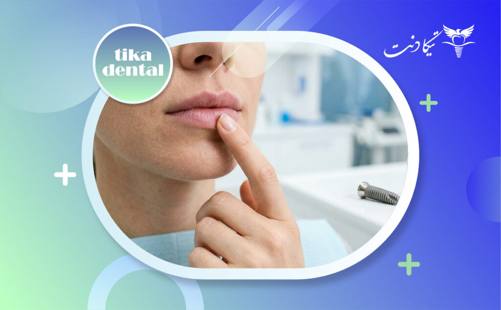 بی حسی لب بعد از ایمپلنت