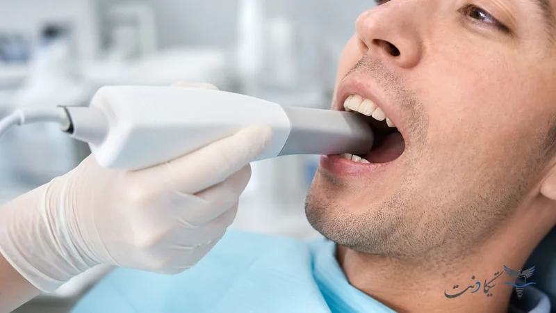 اسکن داخل دهانی در مراحل ساخت لمینت