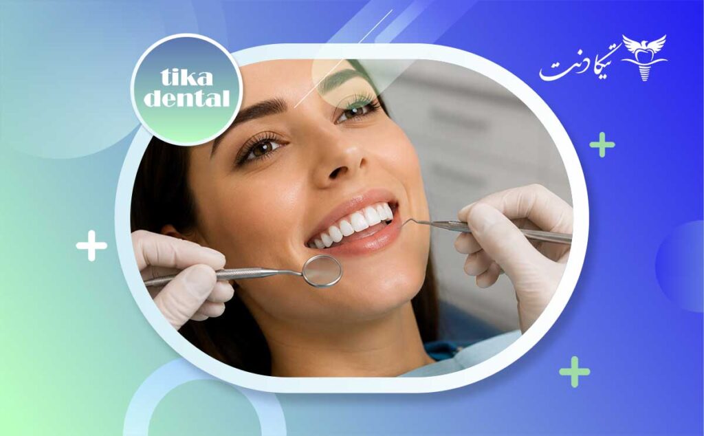 طول عمر کامپوزیت