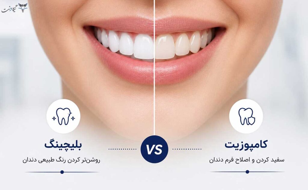 فرق بلیچینگ و کامپوزیت