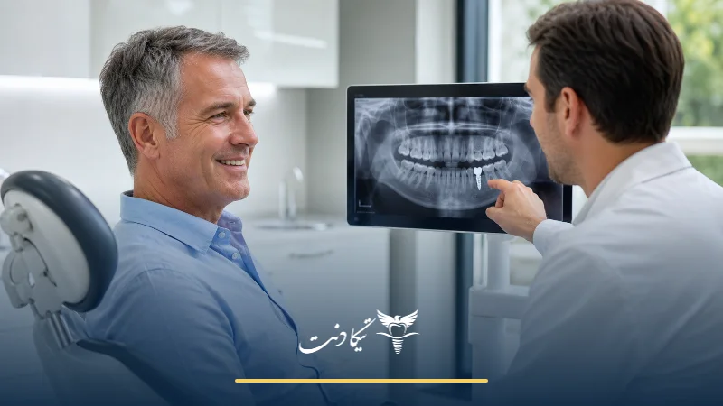 طول عمر ایمپلنت