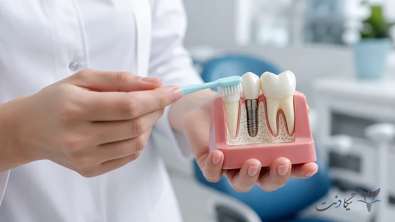 آموزش تمیزکردن اطراف ایمپلنت با مسواک نرم