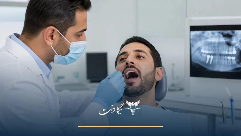 پس زدن ایمپلنت