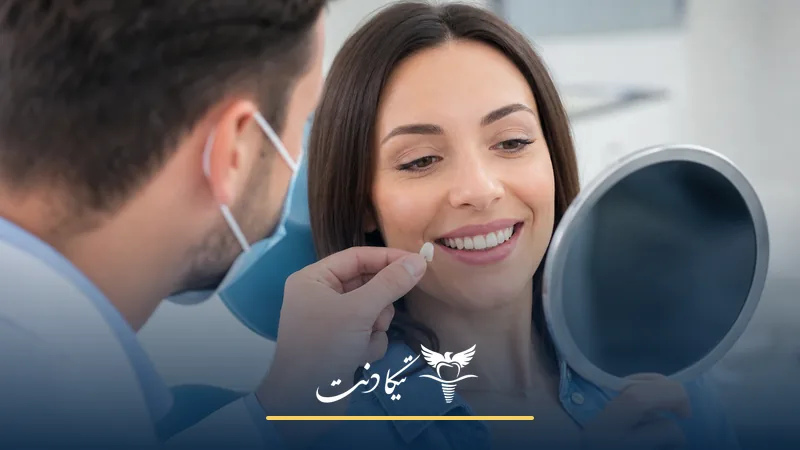 لومینیرز چیست