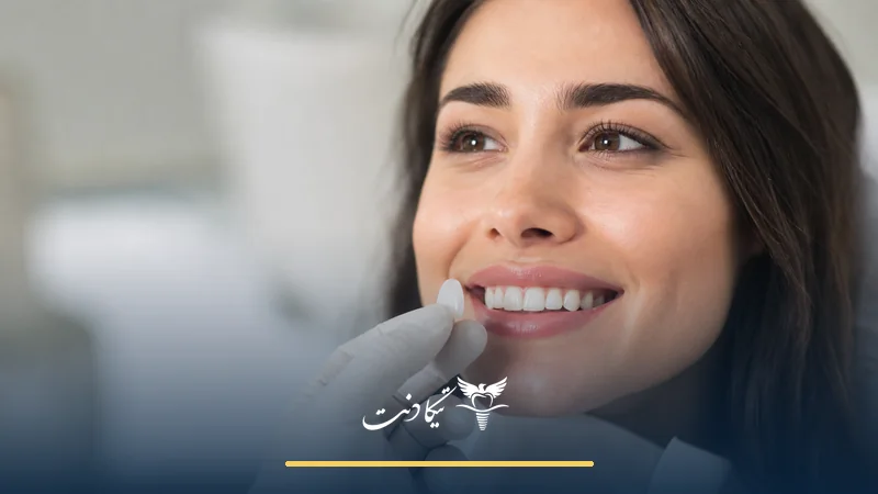 مراقبت های بعد از لمینت دندان