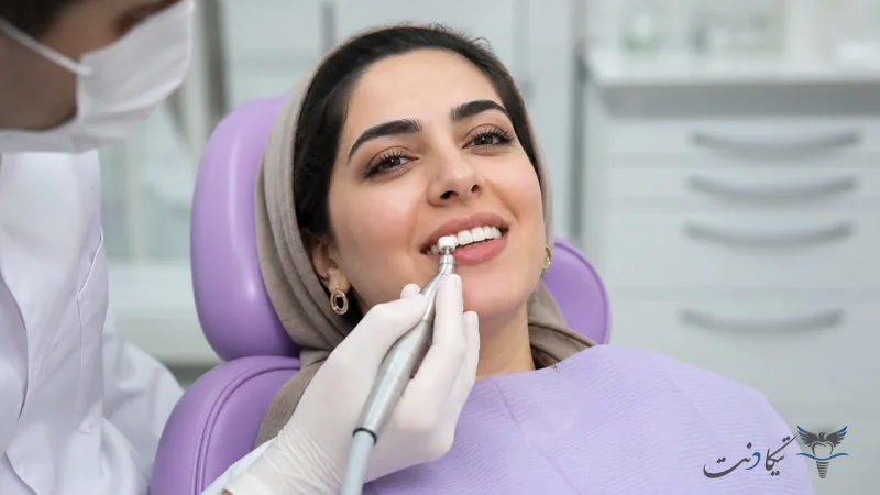 پولیش کامپوزیت نانوسرامیک