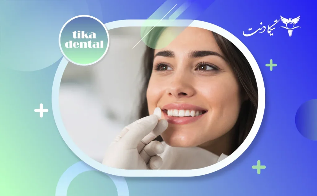 لمینت بدون تراش دندان