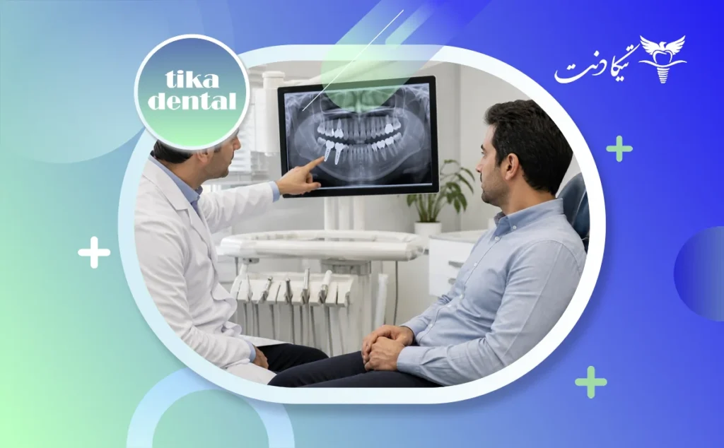 علائم جوش خوردن ایمپلنت