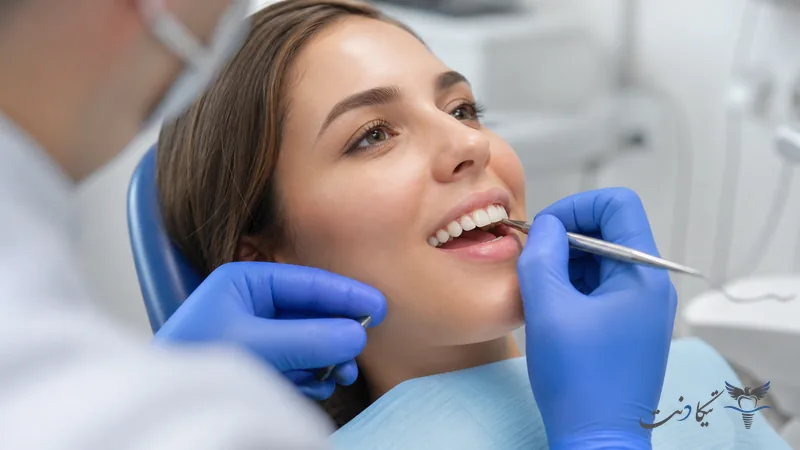 اجرای کامپوزیت کاریزما یا سارمکو