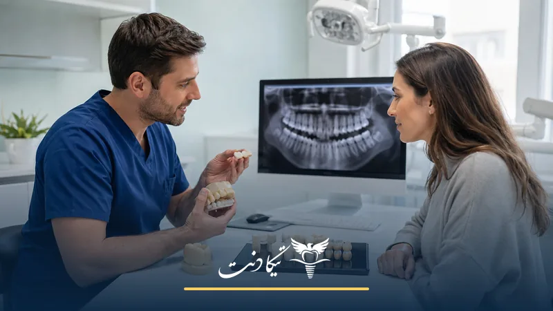 تفاوت لمینت و روکش دندان